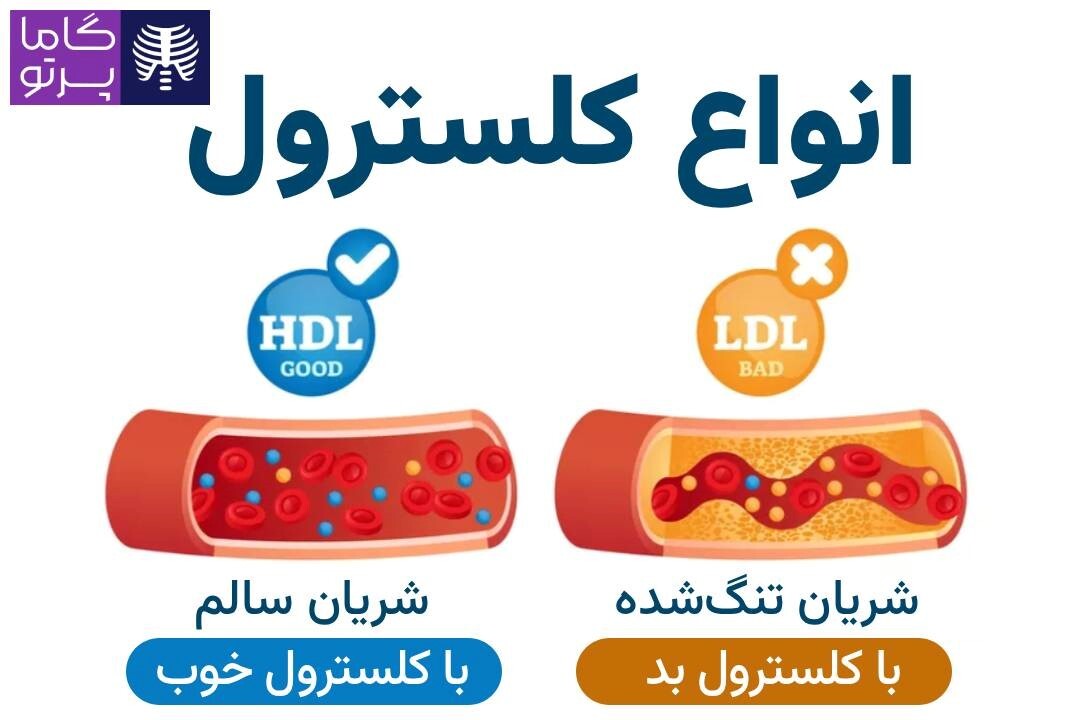 چربی‌های خوب، سپر نامرئی قلب شما (طبق راهنمای هاروارد)