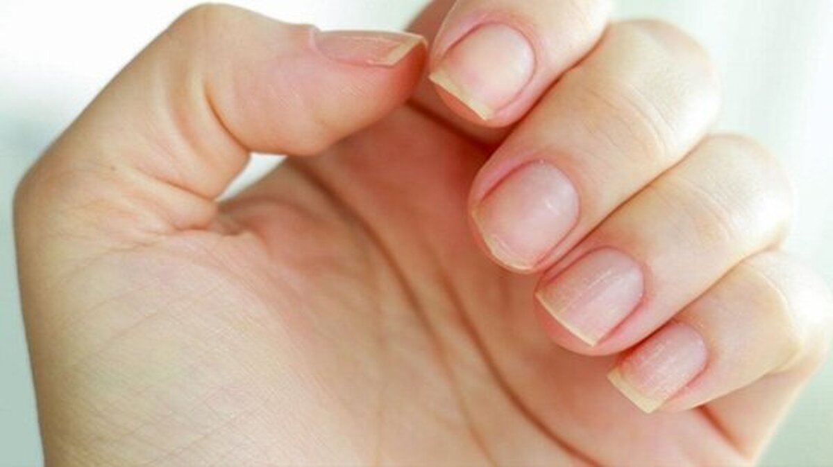هشدار نسبت به ماده براق‌کننده و محکم‌کننده در کاشت ناخن و لاک ژل