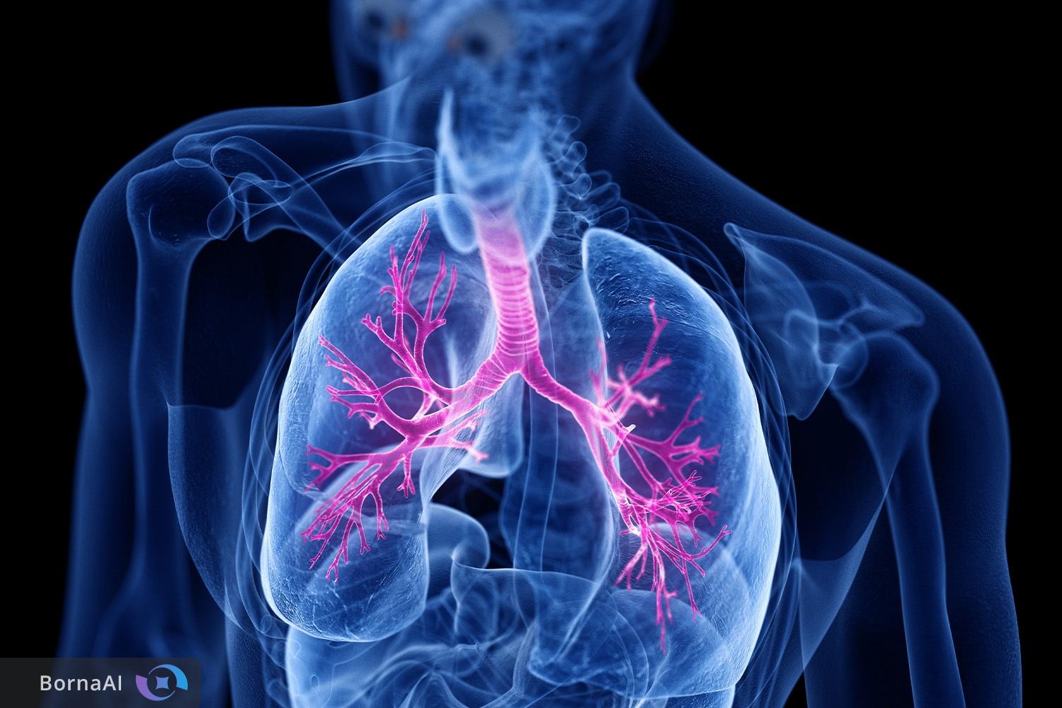 ایران به جمع تولیدکنندگان داروی ضد فیبروز پیوست!