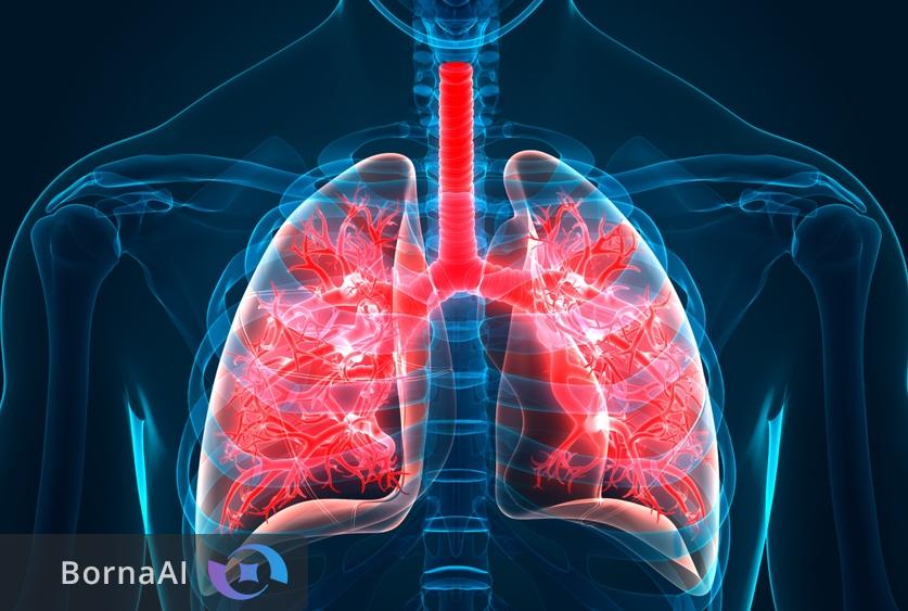 ایران به جمع تولیدکنندگان داروی ضد فیبروز پیوست!