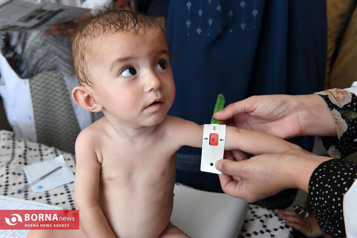 کاهش چشمگیر سوء تغذیه در کودکان زیر پنج سال استان البرز