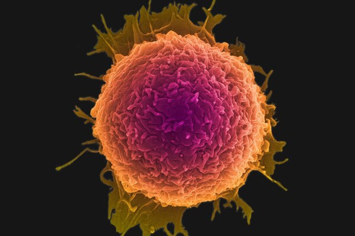 ابتلای روزانه بیش از ۵۰ زن به سرطان پستان/برگزاری هفته «ماموگرافی رایگان» در سراسر کشور