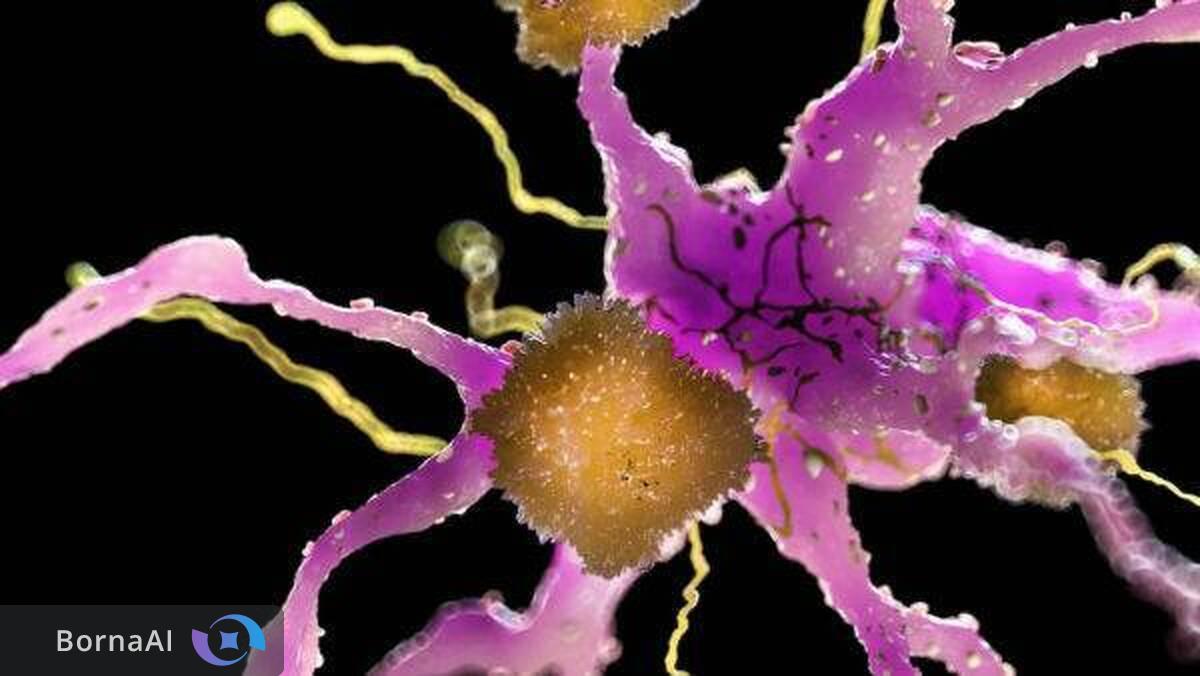 درمان آلزایمر با نانوذرات پلاک‌های مغزی را در چند ساعت پاک کرد!