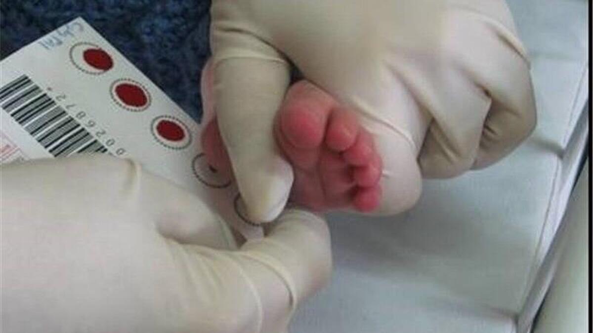 تداوم موفقیت برنامه ملی غربالگری نوزادان با پوشش بیش از ۹۹ درصد