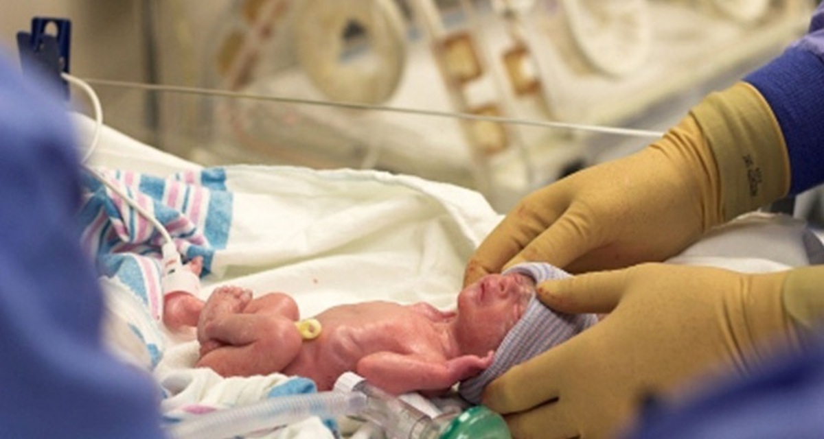 غربالگری بینایی بیش از ۱۰۰۰ نوزاد نارس خوزستان در نیمه نخست سال جاری