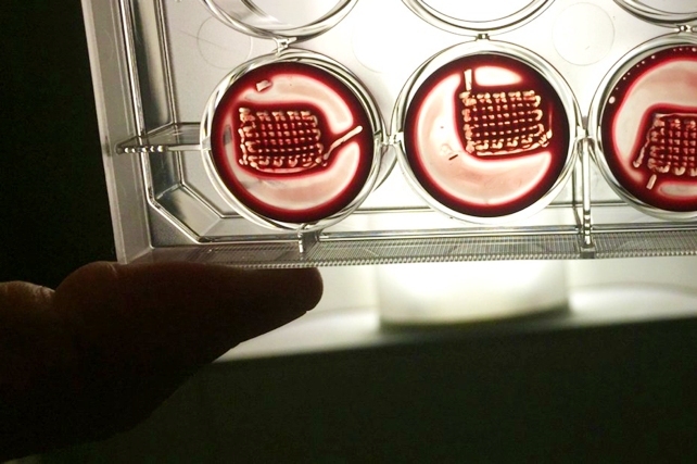 امید تازه برای درمان پوکی استخوان امید تازه برای درمان پوکی استخوان