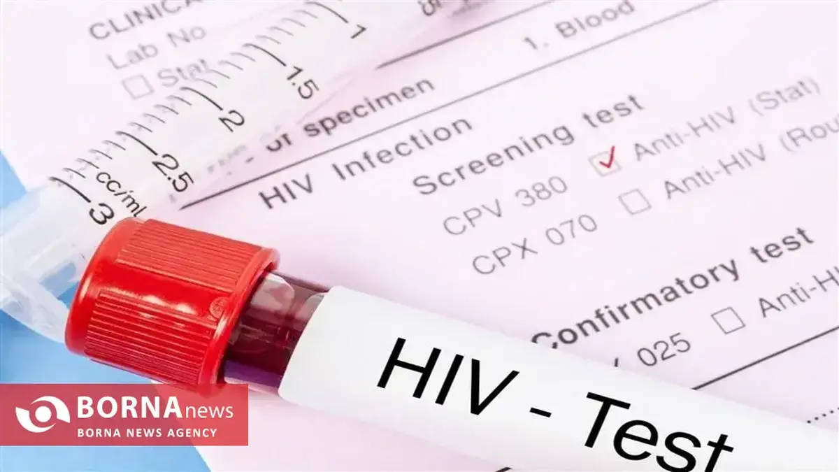 ارائه خدمات به بیماران اچ‌آی‌وی در کرمانشاه رایگان و محرمانه است/ آگاهی‌بخشی و انگ‌زدایی محور برنامه‌های هفته ملی اطلاع‌رسانی ایدز