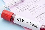 HIV و مکمل‌ها: چه نکاتی را باید بدانید؟