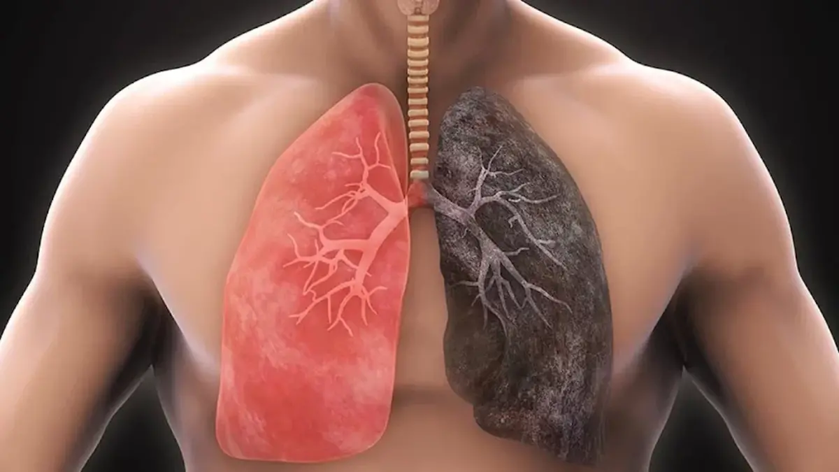 آیا ریه سیگاریها پس از ترک دوباره سالم میشود؟