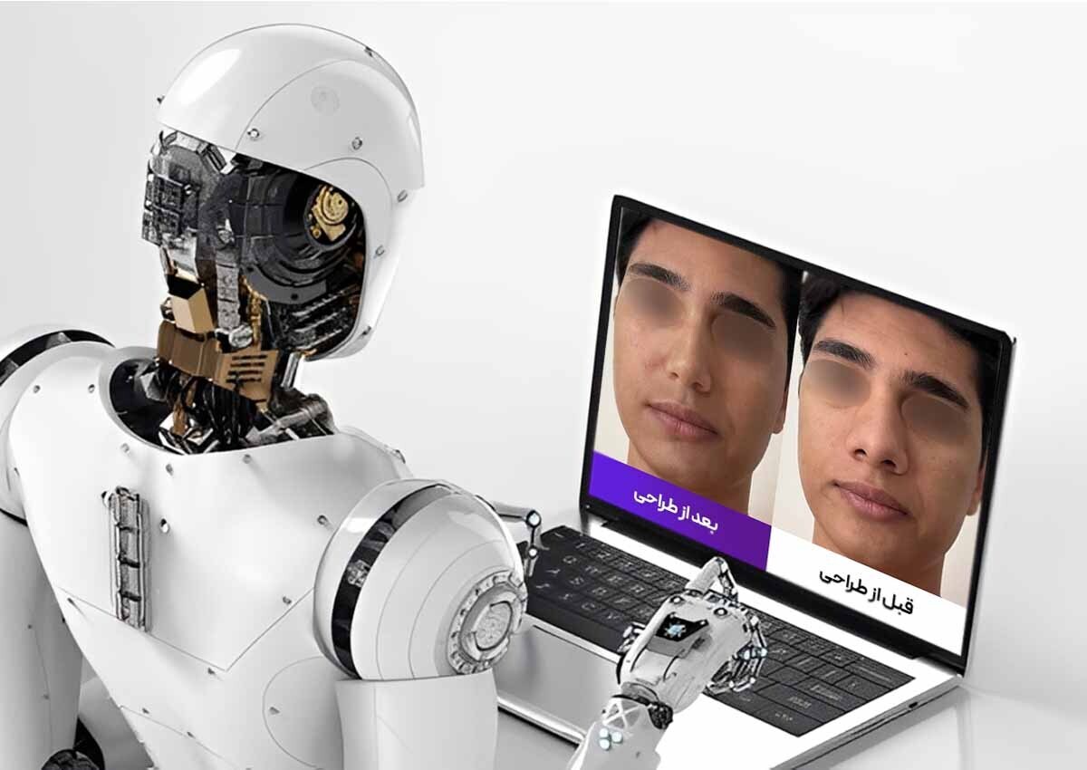 جراحی بینی در تهران با پزشک ۲۴