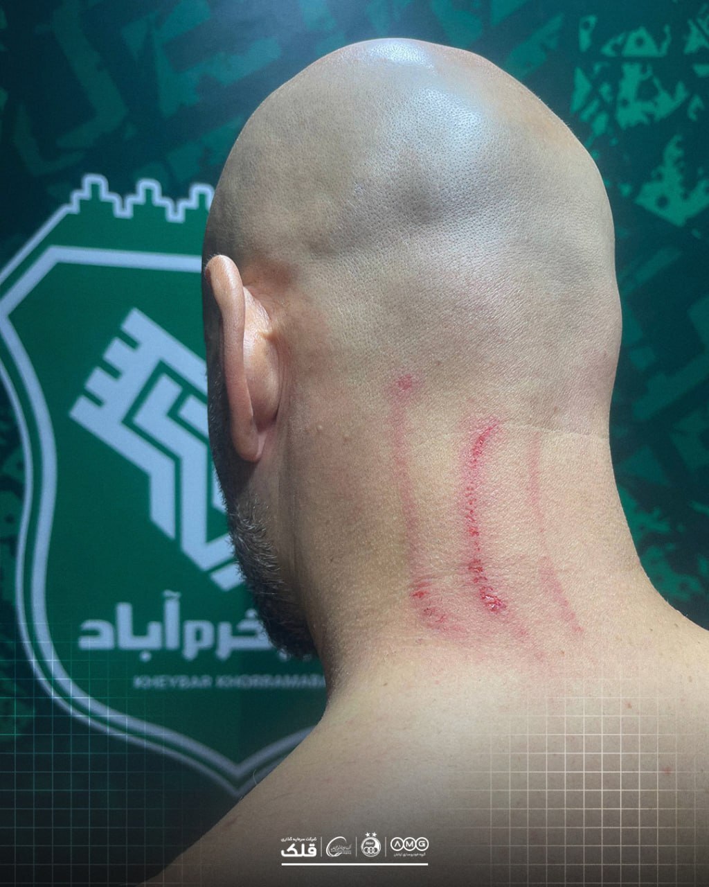 واکنش باشگاه استقلال به درگیری در پایان دیدار با خیبر+ عکس واکنش باشگاه استقلال به درگیری در پایان دیدار با خیبر+ عکس