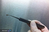 ایمپلنت ریز سلولی؛ امید تازه برای بازگرداندن بینایی بیماران مبتلا به تحلیل لکه‌ای