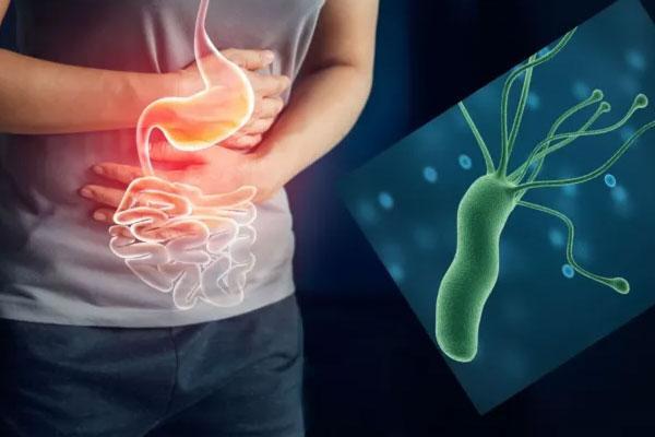 هلیکوباکتر پیلوری یا اچ پیلوری معده چیست؟