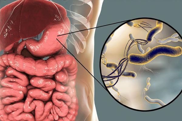 هلیکوباکتر پیلوری یا اچ پیلوری معده چیست؟