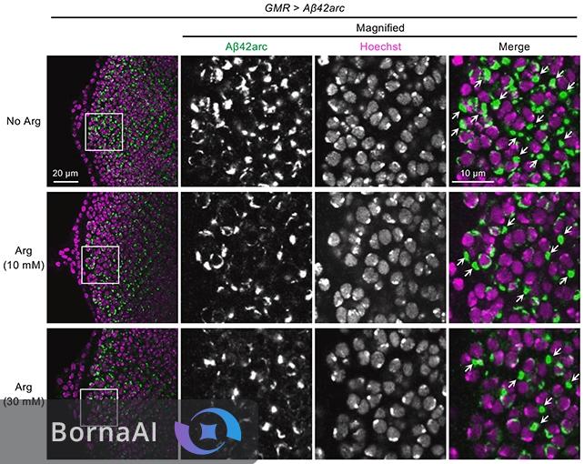 مکملی برای فشار خون بالا نشانههای آلزایمر را محو کرد! مکملی برای فشار خون بالا نشانههای آلزایمر را محو کرد!