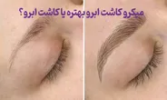 میکرو کاشت ابرو بهتره یا کاشت ابرو؟