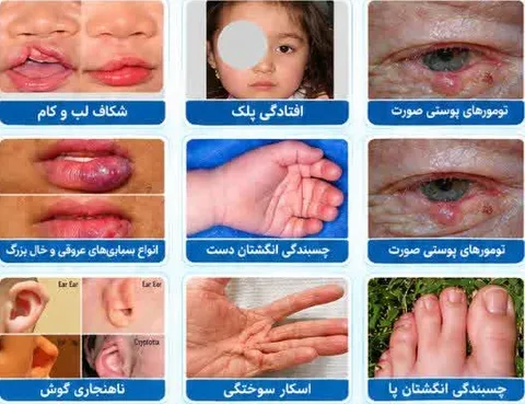 فراخوان شناسایی بیماران نیازمند جراحی پلاستیک و ترمیمی در جنوب غرب خوزستان