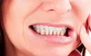 هشدار درباره عوارض جدی دندان‌قروچه و تهدید سلامت ترمیم‌های دندانی