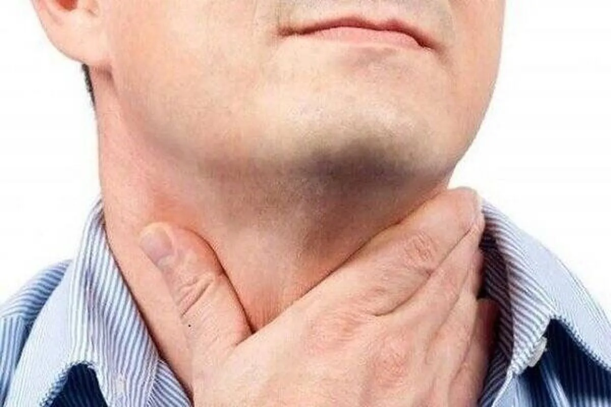 منبع سوزش گلوی مردم مشخص است