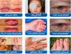 فراخوان شناسایی بیماران نیازمند جراحی پلاستیک و ترمیمی در جنوب غرب خوزستان