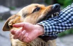 ۴۰ درصد موارد ابتلای انسانی به هاری در کودکان رخ می‌دهد