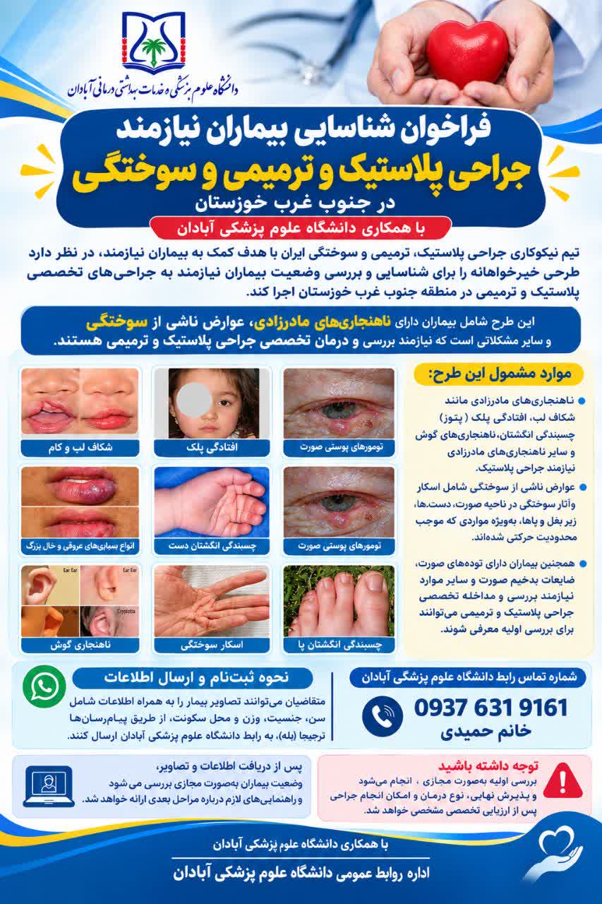 فراخوان شناسایی بیماران نیازمند جراحی پلاستیک و ترمیمی در جنوب غرب خوزستان فراخوان شناسایی بیماران نیازمند جراحی پلاستیک و ترمیمی در جنوب غرب خوزستان
