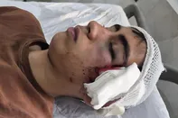 حادثه مصدومیت شدید دانش‌آموز دهبکری بم خبر ساز شد