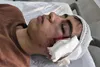 حادثه مصدومیت شدید دانش‌آموز دهبکری بم خبر ساز شد