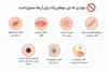 لیزر موهای زائد برای چه کسانی ضرر دارد
